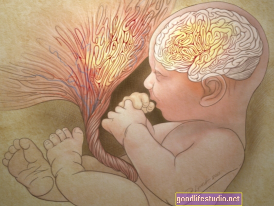 La placenta anormale può rivelare il rischio di autismo