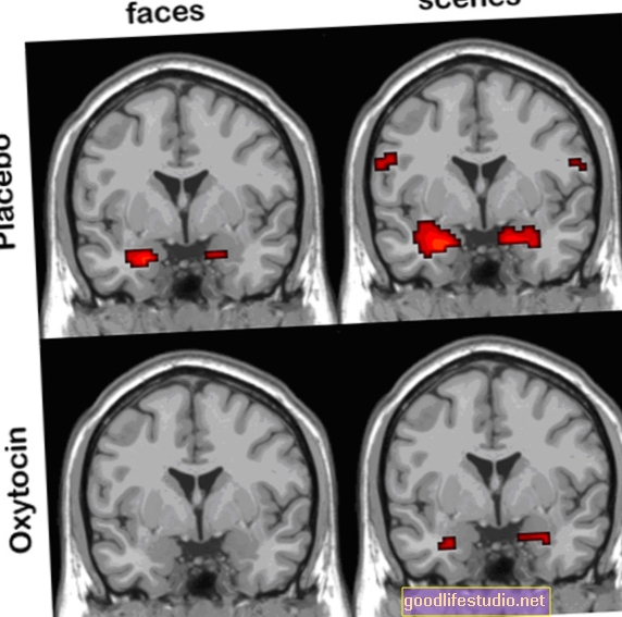La actividad en la amígdala puede ser clave para desarrollar PTSD