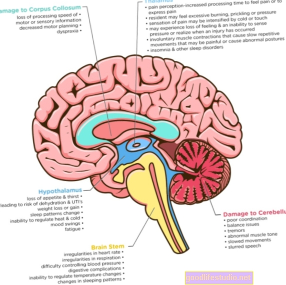 قد يؤدي جين الزهايمر إلى إتلاف الدماغ قبل ظهور الأعراض بوقت طويل
