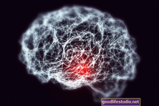 Alzheimer-Forschung zielt auf Varianten klebriger Gehirnproteine ​​ab