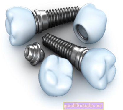 Antidépresseurs liés aux échecs d'implants dentaires
