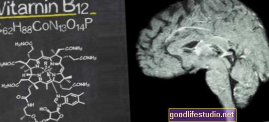 B-Vitamine helfen bei der Behandlung von Schizophrenie