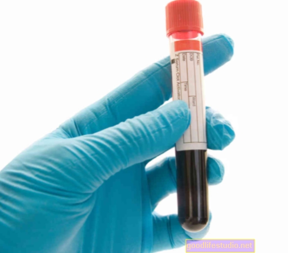 Кръвният тест помага за диагностицирането на шизофрения