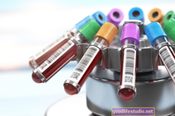 Testul de sânge prezice care pacienți bipolari vor răspunde la ketamină