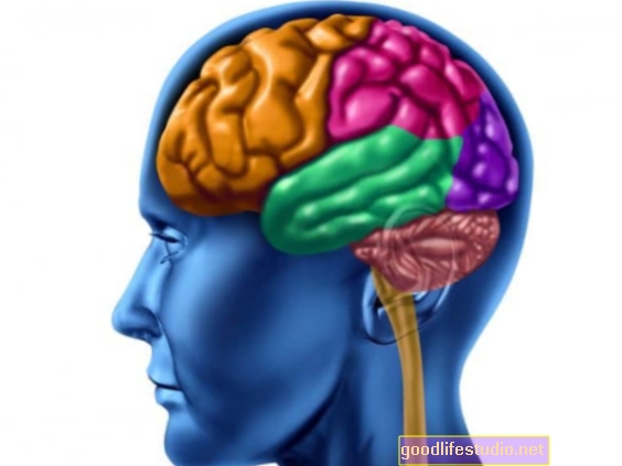 Pola Penuaan Otak Boleh Berlaku Pada Kadar Lebih Pantas pada Pesakit Psikosis