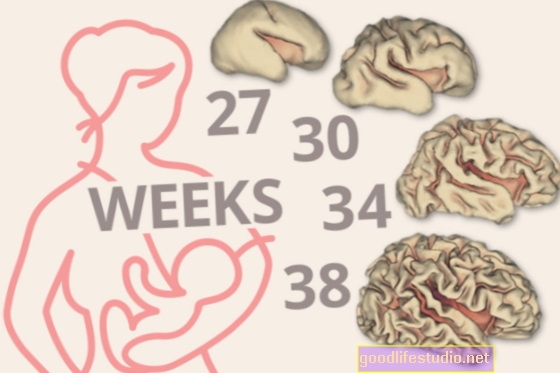 قد يكون اختلاف الدماغ عند الرضع علامة بيولوجية لمخاطر التوحد
