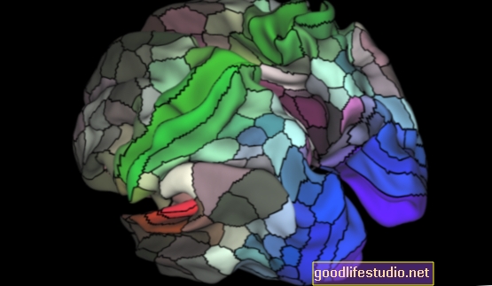Las imágenes cerebrales ayudan a mapear nuestra forma de pensar