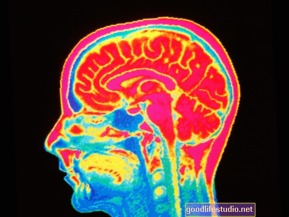Снимање мозга показује шта ставља тинејџере у ризик од злоупотребе супстанци