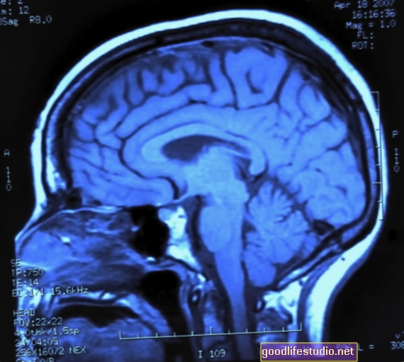 Brain Imaging zeigt, warum Kinder mit Autismus soziale Schwierigkeiten haben