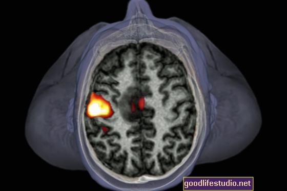 Brain Imaging Study zeigt, dass Yoga vor kognitivem Verfall schützen kann