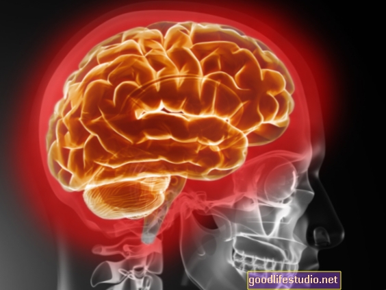 Inflamación cerebral relacionada con el TOC