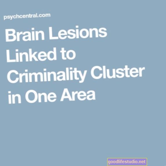 1つの領域で犯罪集団に関連付けられている脳病変