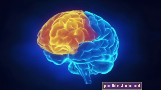 Маркер мозку може виявити ризик психозу у підлітків за допомогою ШІ