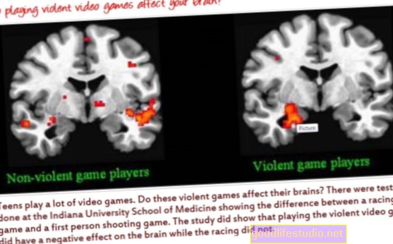 قد تُظهر أنماط الدماغ لمستخدمي ألعاب الفيديو العنيفين الحساسية