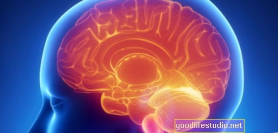 Skenování mozku detekuje včasného Parkinsonovu chorobu