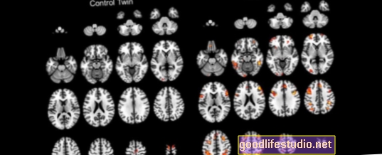 Los escáneres cerebrales pueden mostrar modelos mentales de otros