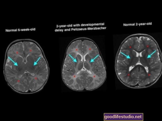 Мозъчните сканирания показват как детските мозъци се променят с ученето