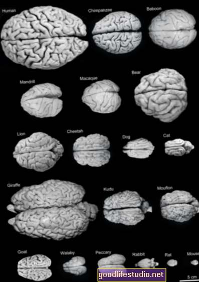 El tamaño del cerebro no parece influir en el coeficiente intelectual