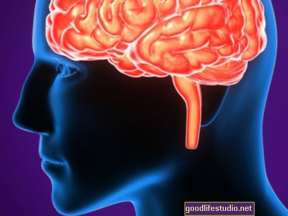 Stimulace mozku může pomoci poznání v Parkinsonově chorobě
