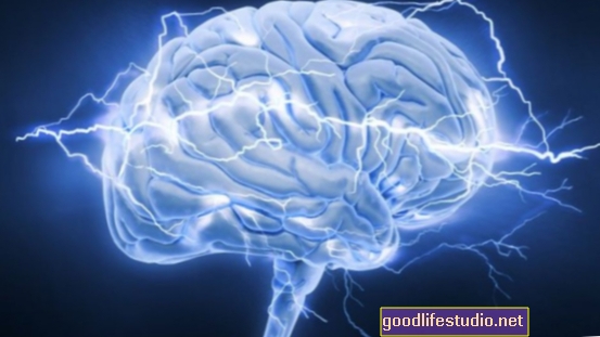 Rangsangan Otak Boleh Meningkatkan Prestasi Atletik