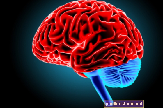 Estudio del cerebro busca "huellas digitales" de trastornos mentales graves