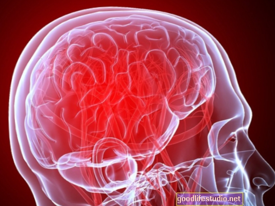 Smadzeņu audu biezums, iekaisums, kas saistīts ar psihozi