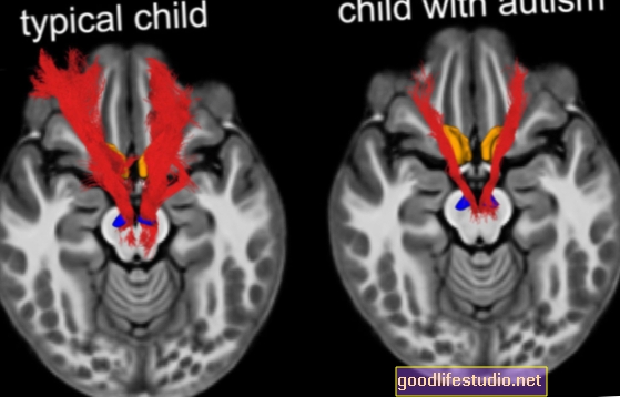 आत्मकेंद्रित सीखने के साथ वयस्कों के दिमाग अलग रूप से सीखने में