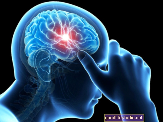 Phản ứng của não với chấn động tương tự như bệnh Alzheimer sớm