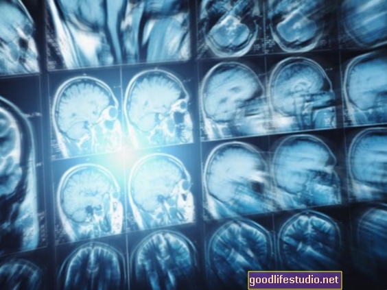 Kanadische Studie: Gehirnerschütterung doppelt so häufig wie gedacht