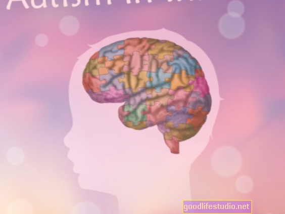 Smegenų jungties ID pokyčiai mažiems vaikams su autizmu