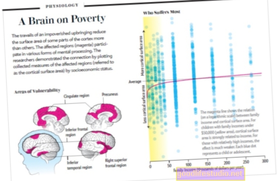 Бедността в детството може да повлияе на познанието в напреднала възраст