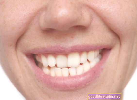 Kõver hambumus võib viidata varase elu stressile