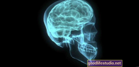Навіть легка травматична травма мозку може спричинити пошкодження мозку