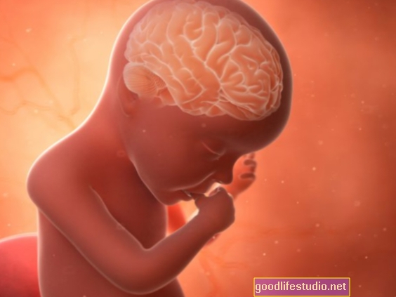 子宮内でのSSRIへの曝露は12年後に認知スキルに影響を与える可能性がある