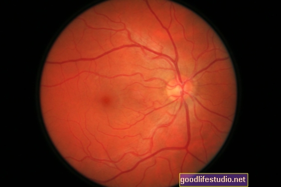 Les scintigraphies oculaires détectent les signes des années d’Alzheimer avant que les patients ne présentent des symptômes