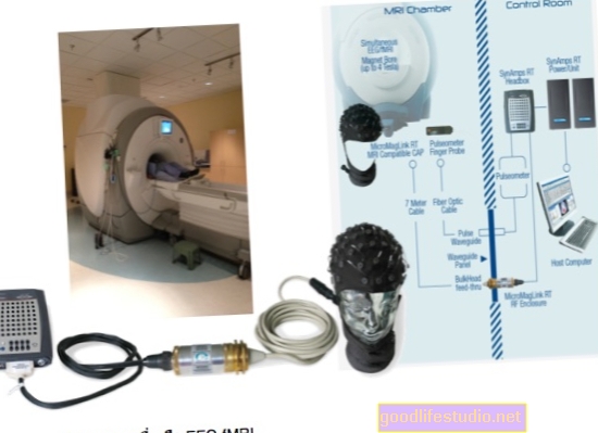 fMRI, Kiểm tra điện não đồ có thể phát hiện ý thức ở bệnh nhân TBI nặng