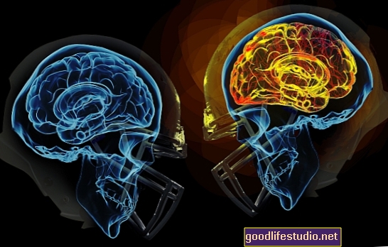 Futbolo smegenų traumos reikalauja daugiau tyrimų