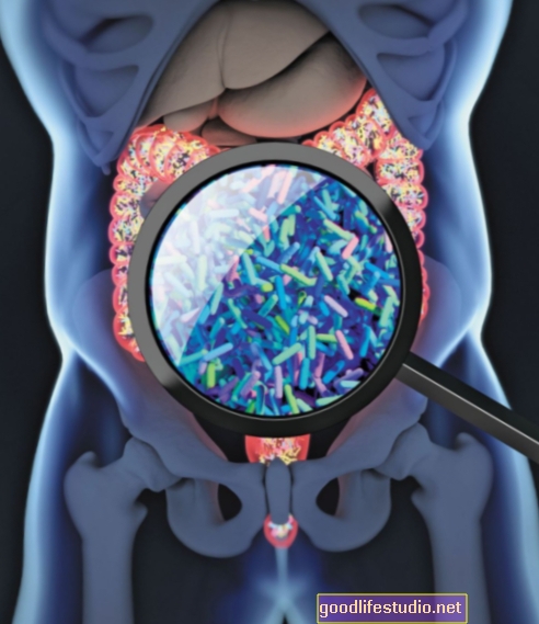 Bacteriile intestinale par diferite la pacienții cu Parkinson timpurii