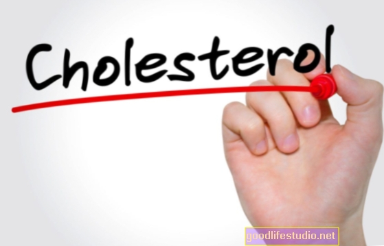 Didelis MTL cholesterolio kiekis susijęs su ankstyvuoju Alzheimerio liga