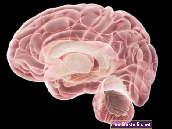 Дисбалансът в свързването на мозъка може да повлияе на развитието на ПТСР