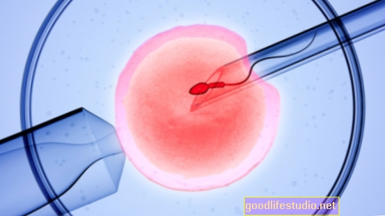 Postopek IVF, povezan z večjim tveganjem za avtizem