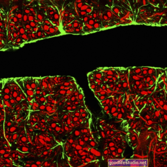 Kapal Darah Bocor di Otak Mungkin Menghidap Demensia Dini