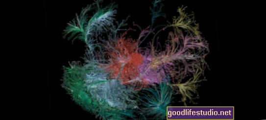 رسم خرائط شبكات الدماغ خلف التفكير المعقد