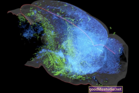Estudio con ratones: las vías del sistema inmunológico cerebral pueden influir en el Alzheimer