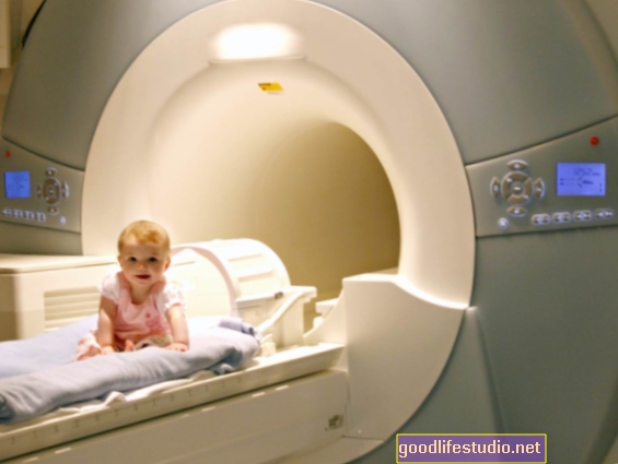 MRI během kojeneckého věku může u vysoce rizikových dětí předpovědět autismus