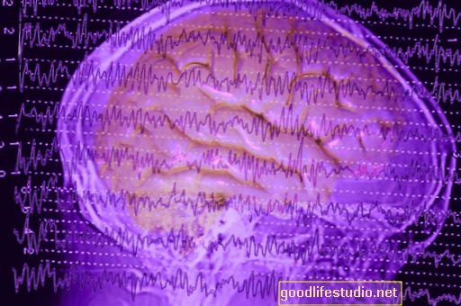 Неуроимагинг показује да су преемије можда ослабиле мождане мреже