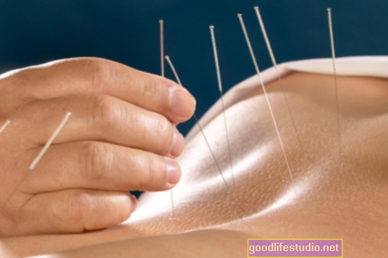 Bolest zmírňující akce akupunktury vyřešena