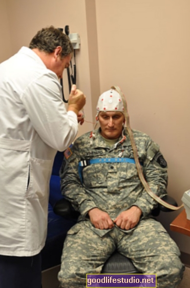 Повторні травми мозку збільшують ризик самогубства солдатів