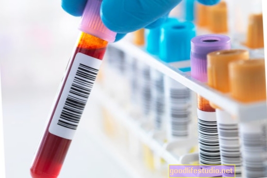 Cercetări privind testul de sânge Alzheimer evidențiat la conferință