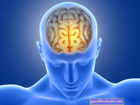 Az „ellenálló” diszlexiásoknak több a szürke anyaguk a Prefrontal Cortexben